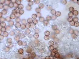 Attēlu rezultāti vaicājumam “Didymium nigripes”