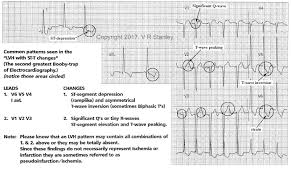 Image result for  ^ L V [ h    