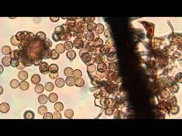 Attēlu rezultāti vaicājumam “myxomicetes”