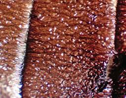 Attēlu rezultāti vaicājumam “Dianema depressum”