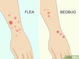 Image result for bed bug bites