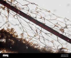 Attēlu rezultāti vaicājumam “Stemonitis axifera var. smithii spores”