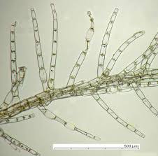 Attēlu rezultāti vaicājumam “Blepharostoma trichophyllum sporophyte”