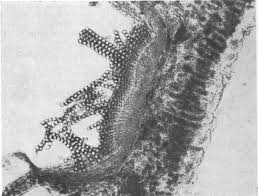 Attēlu rezultāti vaicājumam “Tranzschelia pruni-spinosae spores”