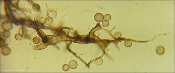 Attēlu rezultāti vaicājumam “Symphytocarpus trechisporus macro”