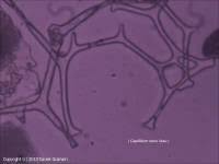 Attēlu rezultāti vaicājumam “Badhamia foliicola spores”