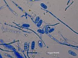 Attēlu rezultāti vaicājumam “Thelopsis rubella”
