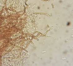 Attēlu rezultāti vaicājumam “Merismodes anomala”