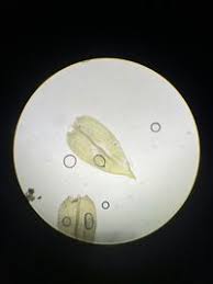 Attēlu rezultāti vaicājumam “Oxyrrhynchium hians var. rigidum macro”