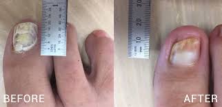 Image result for lunula nail