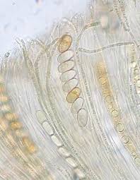 Attēlu rezultāti vaicājumam “Octospora humosa”