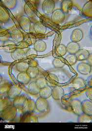 Attēlu rezultāti vaicājumam “Gulielmina vermicularis macro”