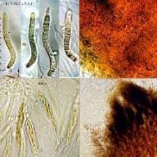 Attēlu rezultāti vaicājumam “Lasiosphaeria ovina”