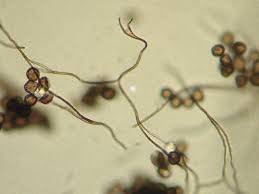 Attēlu rezultāti vaicājumam “Diderma ochraceum macro”