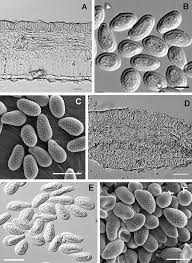 Attēlu rezultāti vaicājumam “Melampsora magnusiana”
