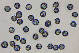 Attēlu rezultāti vaicājumam “Cribraria rubiginosa spores”