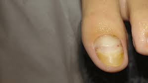 Image result for lunula nail