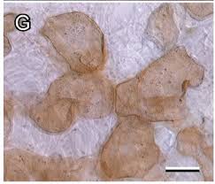 Attēlu rezultāti vaicājumam “Lycogala miserum”