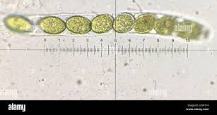 Attēlu rezultāti vaicājumam “Sordaria fimicola”