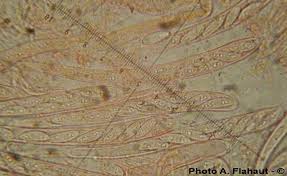 Attēlu rezultāti vaicājumam “Hymenoscyphus calyculus”