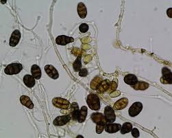 Attēlu rezultāti vaicājumam “Diderma ochraceum spores”