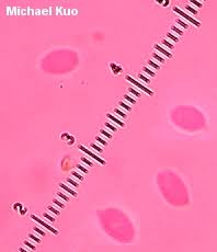 Attēlu rezultāti vaicājumam “Collybia tuberosa”