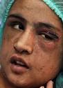 Enlarge Shocking: Sahar Gul,