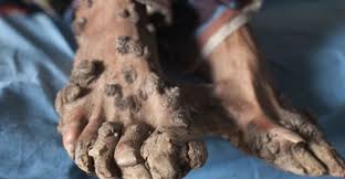 Image result for Lewandowsky-Lutz