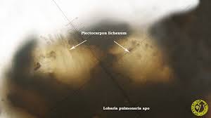 Attēlu rezultāti vaicājumam “Plectocarpon lichenum”