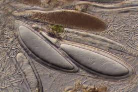 Attēlu rezultāti vaicājumam “Pertusaria pertusa”