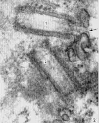 Attēlu rezultāti vaicājumam “Physarum flavicomum stalked”