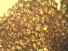 Attēlu rezultāti vaicājumam “Ophiostoma polyporicola”