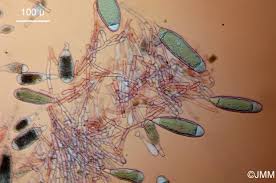 Attēlu rezultāti vaicājumam “Bactridium flavum”