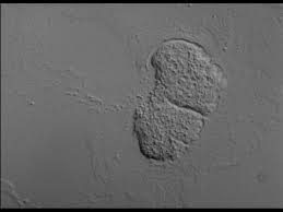 Attēlu rezultāti vaicājumam “Didymium spongiosum plasmodium”