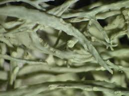 Attēlu rezultāti vaicājumam “Ramalina farinacea”