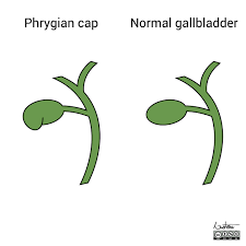 Image result for Phrygian cap