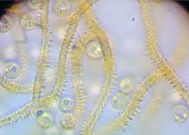Attēlu rezultāti vaicājumam “Heterotrichia oerstedii (syn. Arcyria oerstedii) spores”