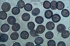 Attēlu rezultāti vaicājumam “Fuligo septica var. flava spores”