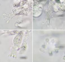 Attēlu rezultāti vaicājumam “Sistotrema confluens”