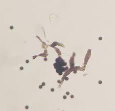 Attēlu rezultāti vaicājumam “Badhamia lilacina spores”