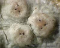 Attēlu rezultāti vaicājumam “Pertusaria leioplaca”