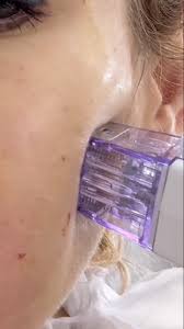 Картинки по запросу белку зажевало в диск