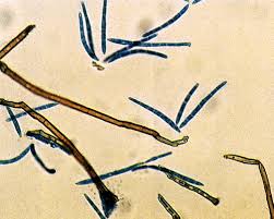 Attēlu rezultāti vaicājumam “Reticularia jurana spores”