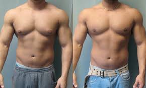 Image result for manboobs