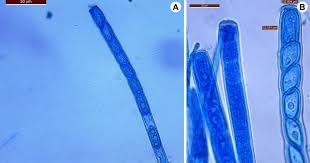 Attēlu rezultāti vaicājumam “Helvella atra”