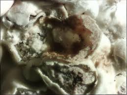 Attēlu rezultāti vaicājumam “Diderma subincarnatum sessile”