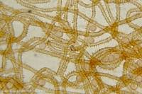 Attēlu rezultāti vaicājumam “Heterotrichia oerstedii (syn. Arcyria oerstedii) spores”