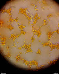 Attēlu rezultāti vaicājumam “Lycogala fuscoolearium macro”