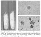 filamentous colonies which