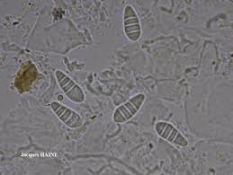Attēlu rezultāti vaicājumam “Arthonia leucopellaea”
